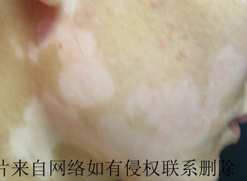 糤沿Ҫô